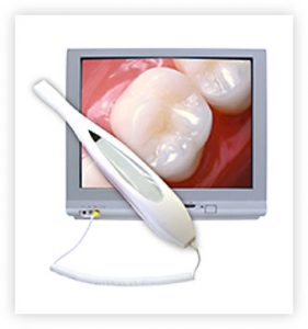 Intra Oral Camera